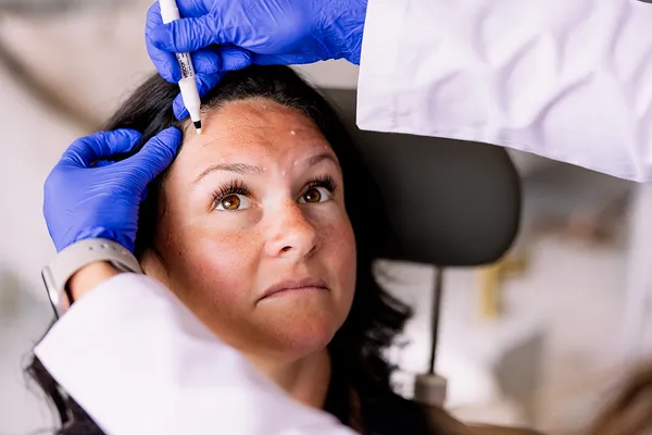 Lyndsay marking precise injection points on a patient's forehead